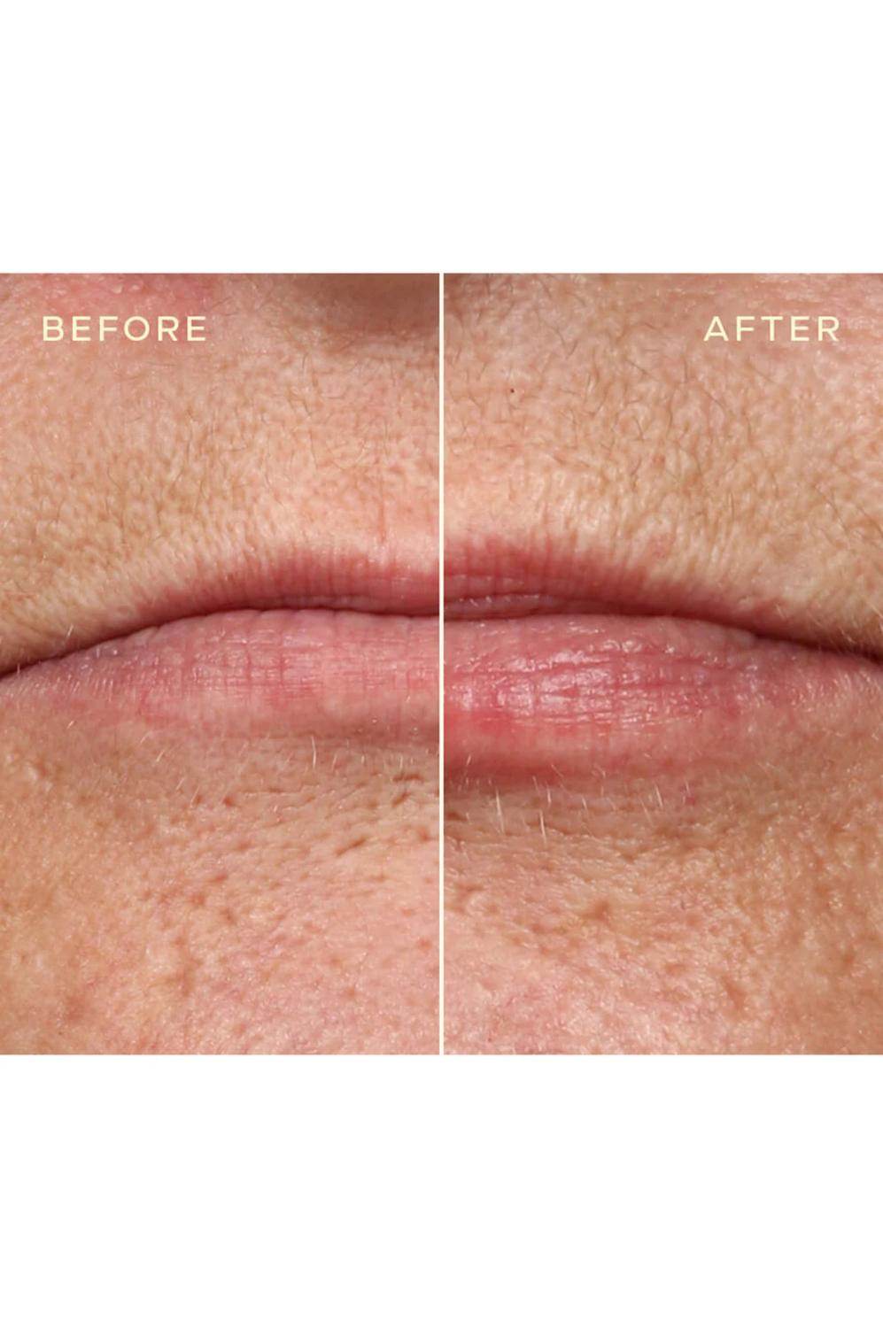 Ourself - Lip Filler Refill - Rack Hunt